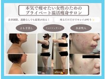 ヨサパーク ベル(YOSA PARK Belle)