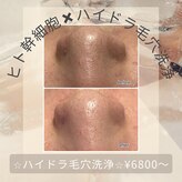 エンチャント(ENCHANT)