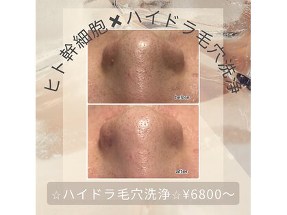 エンチャント(ENCHANT)の写真