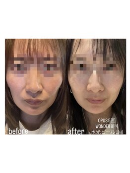 フロル(FLOR)/WONDER lift