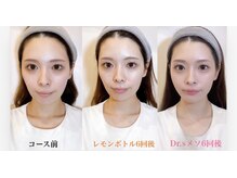 イーズ ららぽーと湘南平塚店(E/S)/
