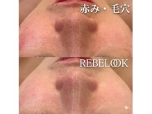 ブルーローズサロン 金沢駅前 武蔵店(Blue Rose salon)の雰囲気（黒ずみ毛穴・乾燥・くすみ・肌荒れ改善！ツヤ肌になりたい方へ）