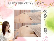 アネラ(ANERA) 心斎橋/40代ボリューム悩みバストアップ