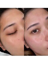 ウミ(Ummi)/HBL＋フェイスワックス