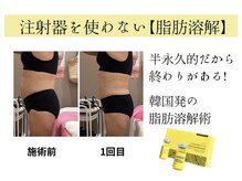 イーズスリミングプロ 横浜コレットマーレ店の雰囲気（レモンボトル1回の結果!脂肪分解×リンパ×ラジオ波120分11000円）