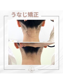 ミース 宮崎店/うなじ脱毛専門店ならではの効果