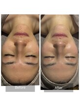 エヌア(nA)/クリスティーナ【アンストレス】