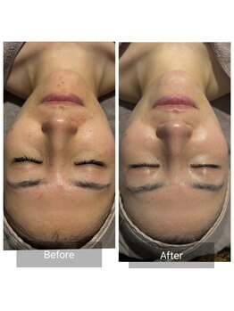 エヌア(nA)/クリスティーナ【アンストレス】