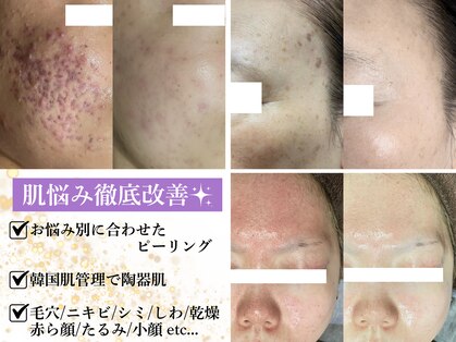 ラヴィアンローズ 泉店 (La vie en Rose)の写真