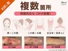 【お試し割】術後インディバ90分＜お顔も◎＞◆3回までOK ￥16000→