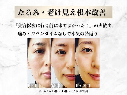 リシェス(Richesse)の写真