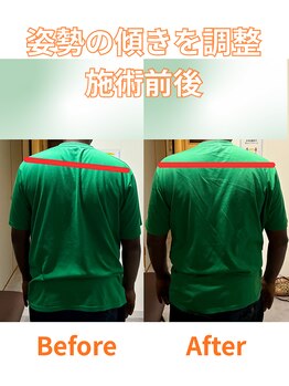 整体院シェアリング 星ヶ丘(SHARING)/姿勢調整による変化【千種区】