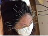 【学割U24】平日開院～14時、土曜日限定　美容鍼施術　１回　￥8,000→￥5500