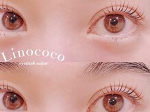 リノココ(Linococo)