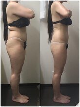 ラボーテ/LaBeauteで痩せる１