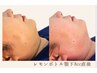 【NEW・韓国発】速効効果☆脂肪分解《レモンボトル》+小顔造形+フォト　¥9800