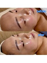 リボーン(be reborn)/赤み・黄みが抑えられます！