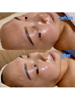 リボーン(be reborn)/赤み・黄みが抑えられます!