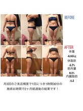 アンリール 旭川店(Anrire)/BODY施術のお客様です！