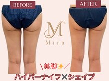 ミラ 札幌店(Mira)/美脚×ハイパーナイフ