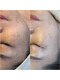ビマリア(美-MARIA)の写真/【諦めていたくすみやシミ改善】ノーファンデでも自信が持てる素肌へ