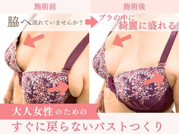 ベルフルール/脇肉・背中が気になる方へ/熊本