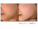 ピーロ ルレ(salon Piilo Rule)の写真