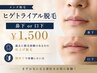 ヒゲ脱毛トライアル   鼻下or口下　 