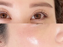 フォルトゥーナ(fortuna)