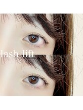 リトマ(RITOMA)/ラッシュリフト