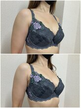 バーディー(BIRDIE)/施術１回/4０代