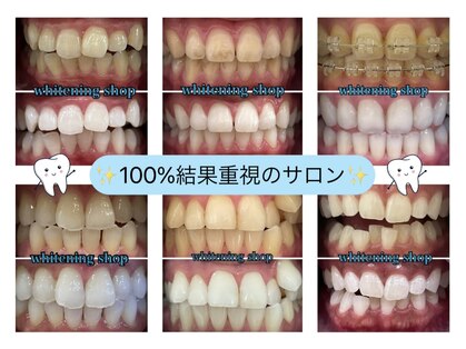 ホワイトニングショップ 盛岡店(WHITENINGSHOP)の写真