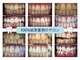 ホワイトニングショップ 盛岡店(WHITENINGSHOP)の写真