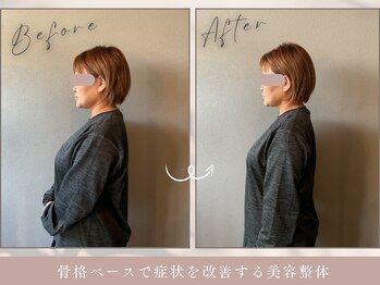 ほぐし屋 かすがい/猫背巻き肩矯正