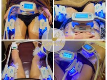 カメリー座薫 大阪上本町本店/4ヶ所同時可能♪冷却痩身