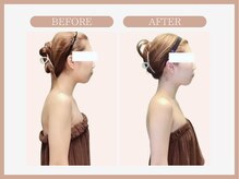 スリムライン 仙台店(The Slim Line)/before→after