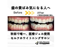 セルフダック ビューティーラグーン 秋田楢山店(SELFDUCK BeautyRaccoon)の雰囲気(自慢の白い歯へ◎)