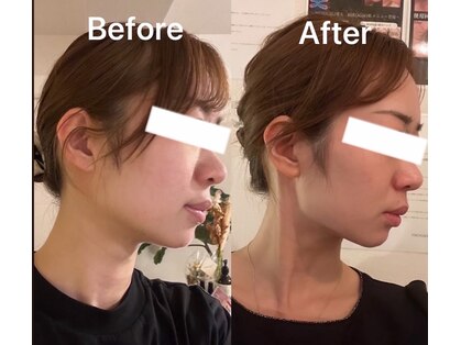 ハイコガオ 中崎町店(HIKOGAO)の写真