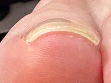 ケアプラス(care plus)