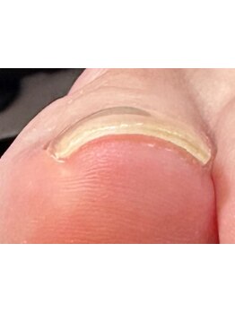 爪の悩みを解消できる（ケア含む）