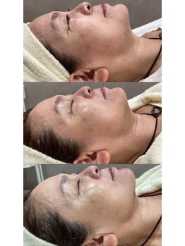 ピリナ(Pilina)/3ヶ月で劇的変化!!