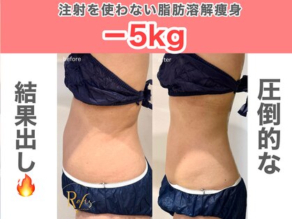 ラヴィス(ravis)の写真