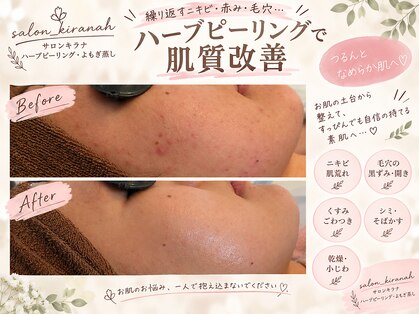 サロン キラナ(SALON Kiranah)の写真