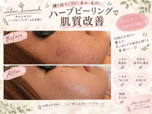 サロン キラナ(SALON Kiranah)