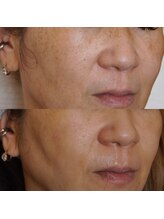 エトル(etole)/40代お客様症例写真