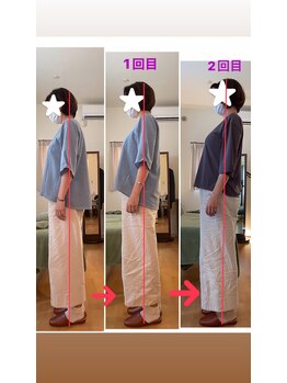 整体工房 煉/骨盤と背骨中心の骨格矯正です。