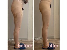 ルプリュシュ ルフレ(Le plus reflet)/痩身