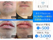 エリート 神戸三宮(ELITE)