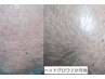 ヘッドグロウ・シングル60分★16500円→15000円