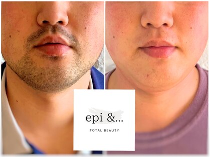 エピアンド(epi &…)の写真